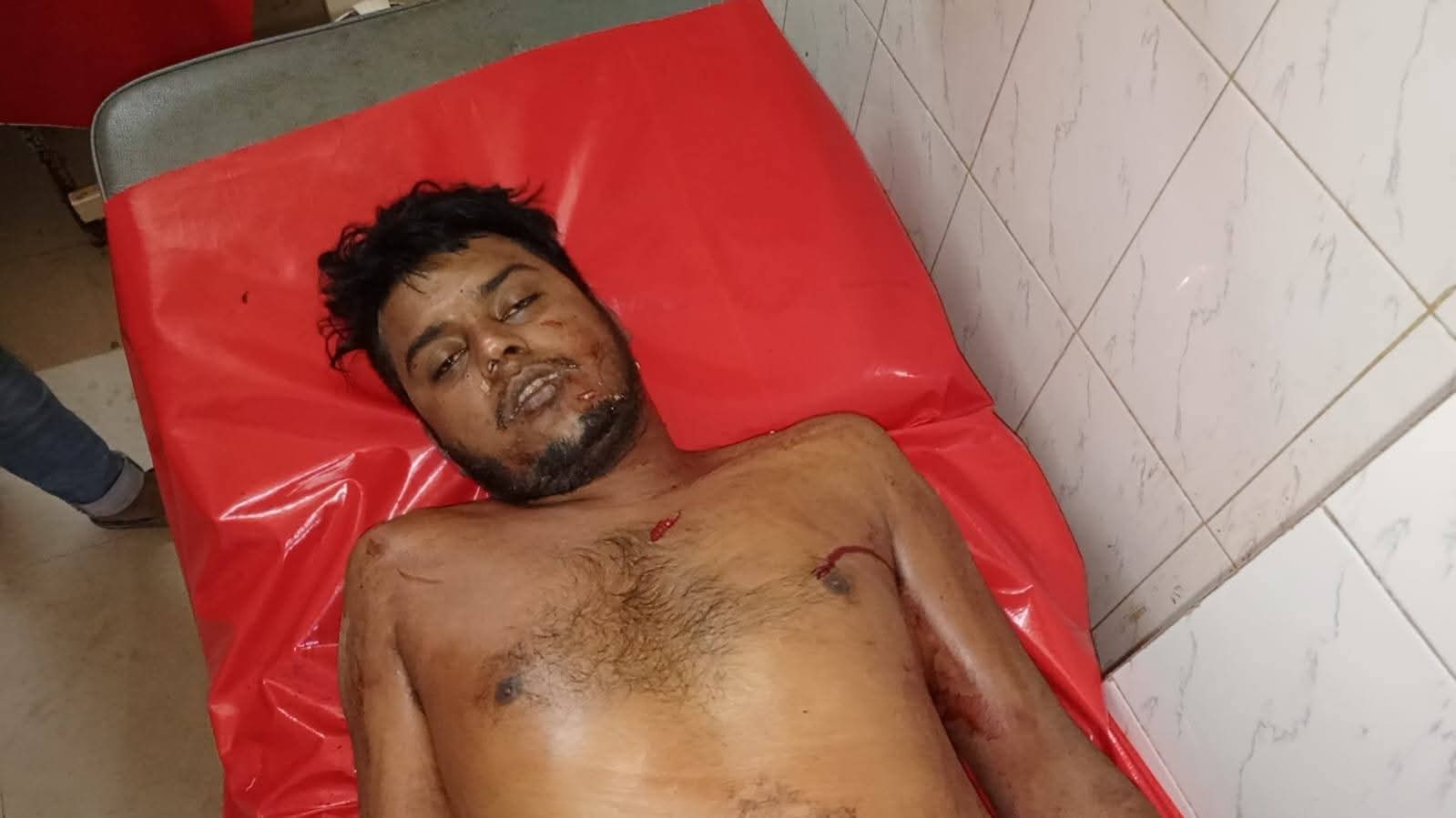 সারিয়াকান্দিতে জমি নিয়ে বিরোধের বিরোধে প্রতিপক্ষের হামলায় শিক্ষক নিহত,আহত ৫