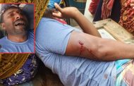 শার্শায় চাঁদার দাবিতে যুবককে হাতুড়ি দিয়ে পিটিয়ে জখম